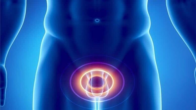 Bol za prostatitis